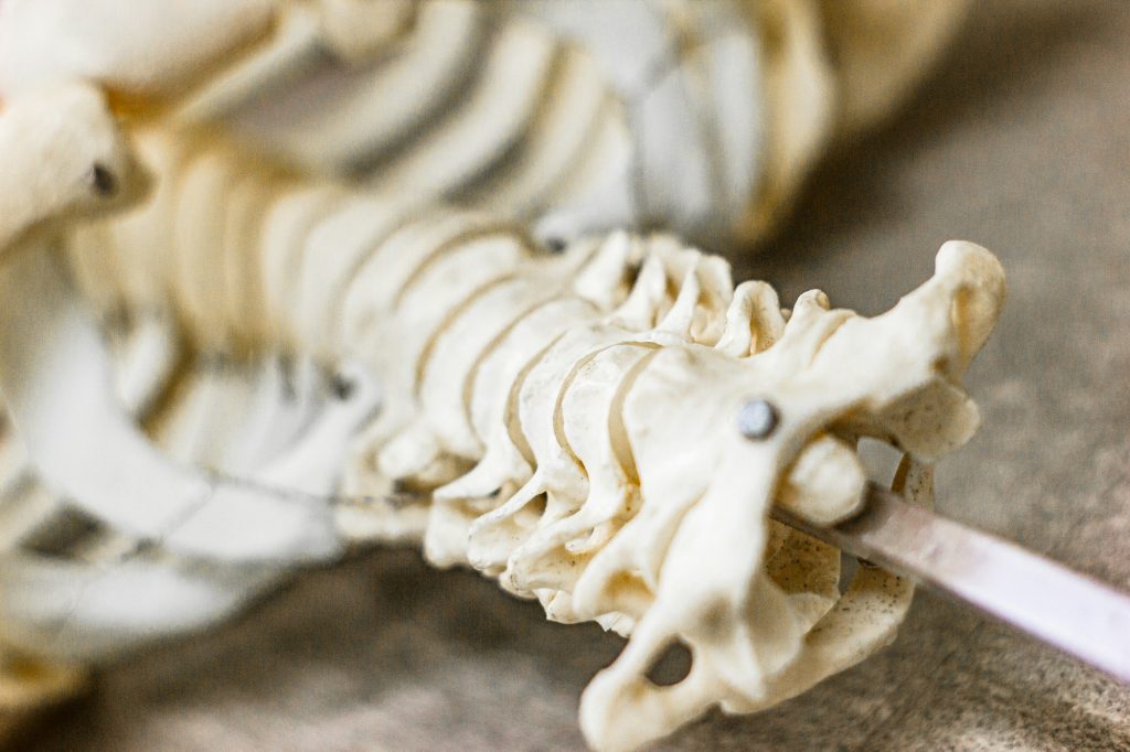 Anatomical illustration of the lower spine and lumbar vertebrae